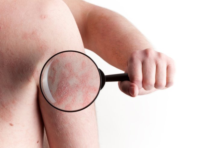 Снимка: istock