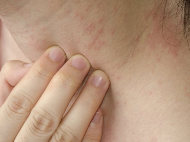 Снимка: Thinkstock