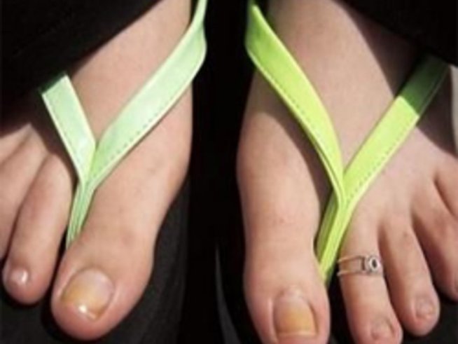 Здрави, блестящи и красиви нокти на краката...Открийте разликата! 