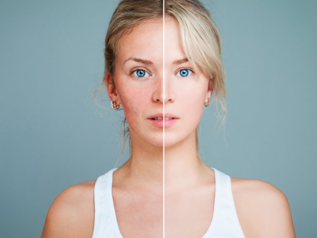 Снимка: istock