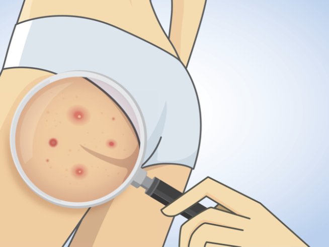 Снимка: istock