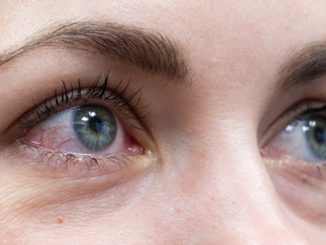 Снимка: istock