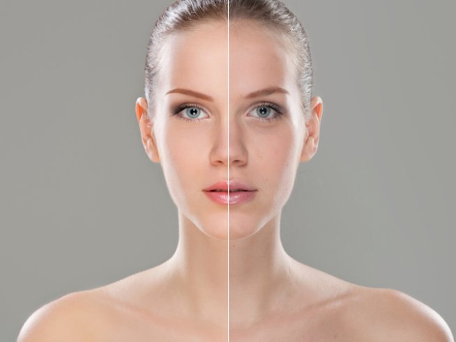 Снимка: Thinkstock