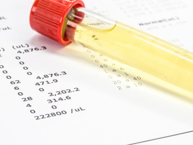 Снимка: istock