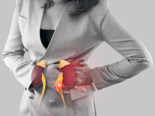 Снимка: istock