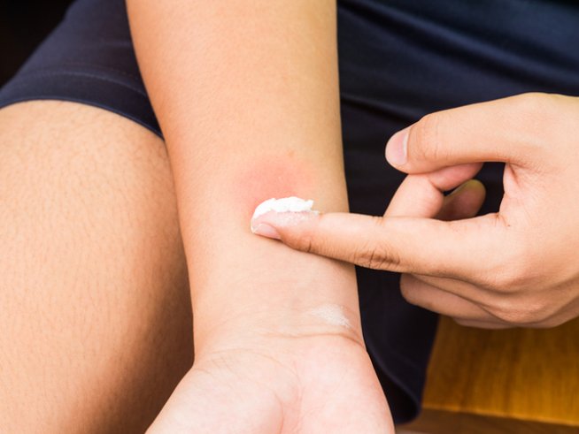 Снимка: istock