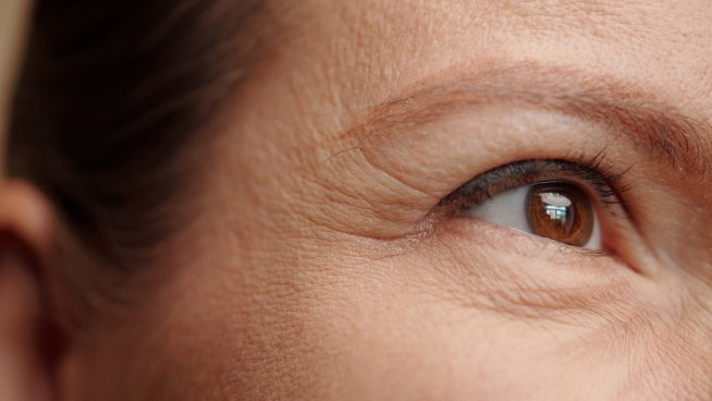 Някои храни състаряват кожата преждевременно. Снимка: istock