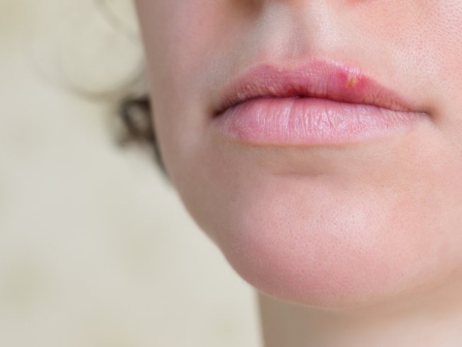 Снимка: istock