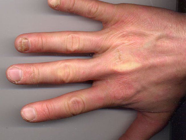 Снимка: Wikimedia Commons