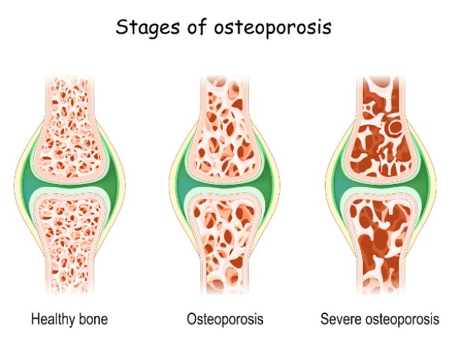 Снимка: istock