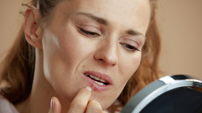 4 причини за поява на херпес. Снимка: istock