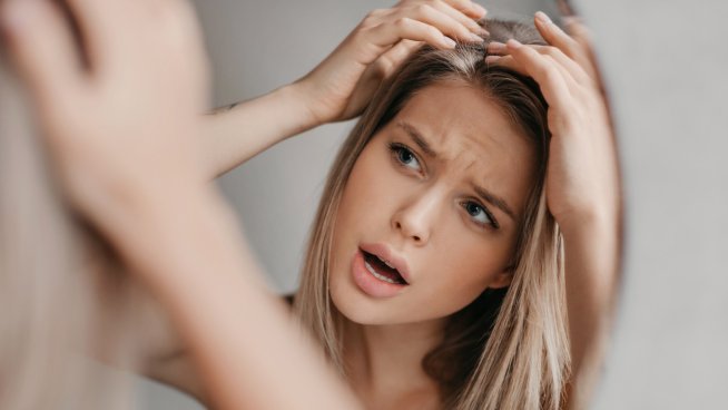 Домашни маски за коса против пърхот. Снимка: istock