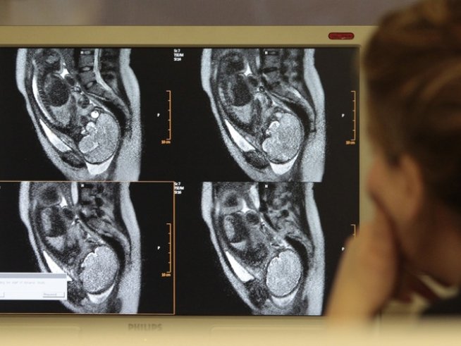 След колко менструални цикъла и редовен секс настъпва бременност?