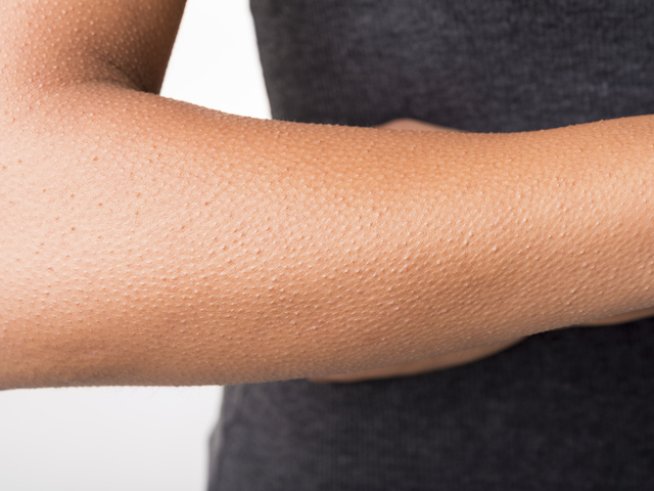 Снимка: Thinkstock