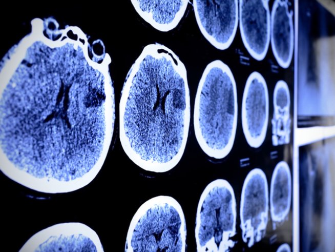 Снимки: istock