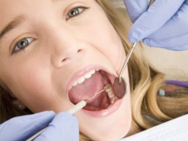 Какви стоматологични услуги заплаща Здравната каса