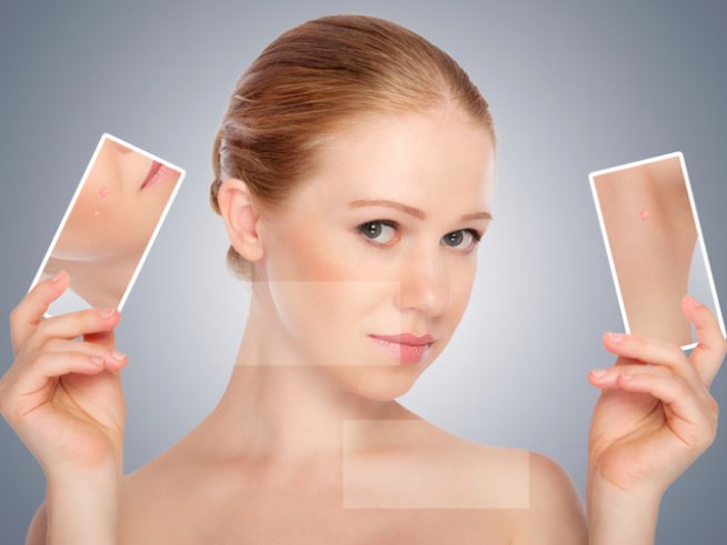 Снимка: thinkstock