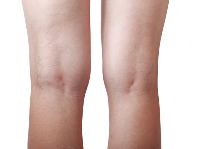 Снимка: istock