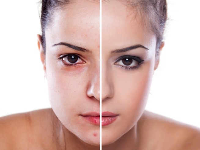 Снимка: Thinkstock