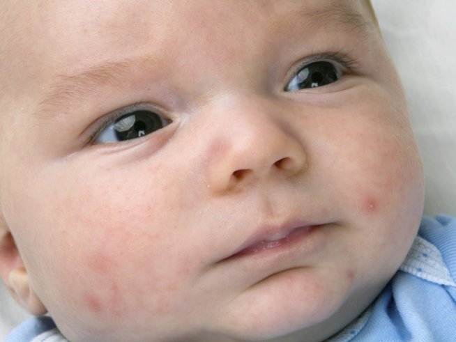 Снимка: Thinkstock