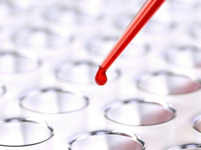 Снимка: Thinkstock