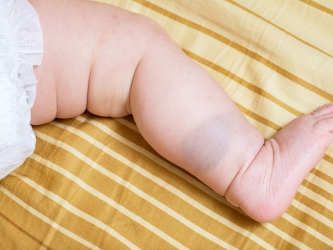 Снимка: iStock