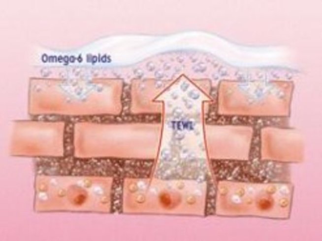 Омега-6 липиди – защо са важни за бебета със суха кожа?