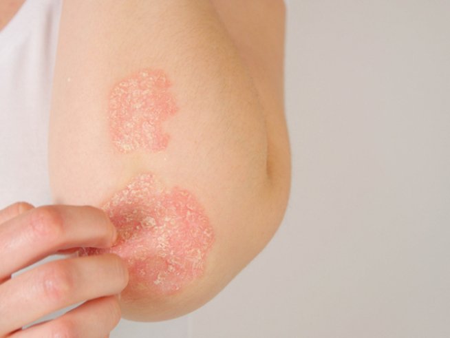 Снимка: istock