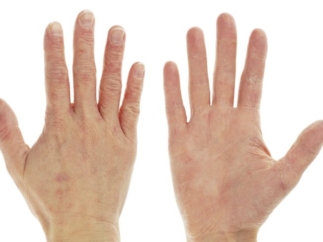 Снимка: Thinkstock