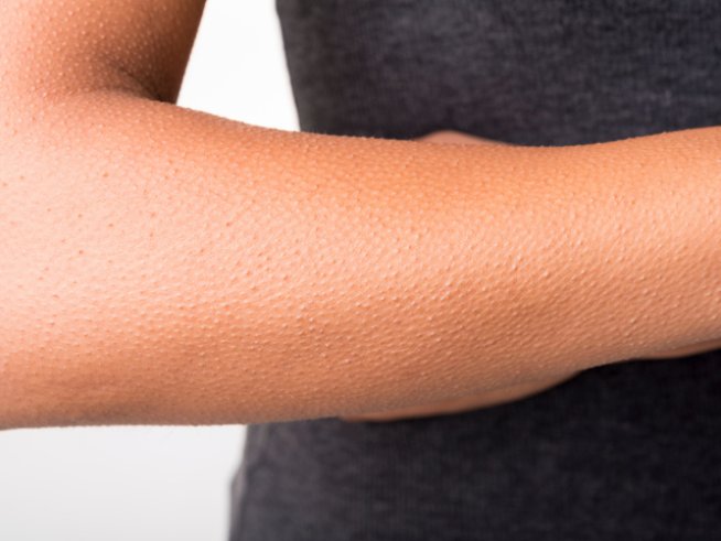 Снимка: Thinkstock