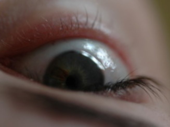 20000 българи нямат пари да се лекуват от глаукома