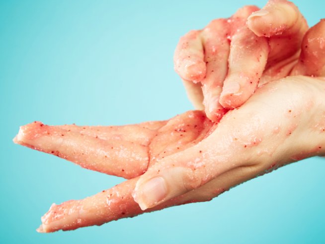 Снимка: istock