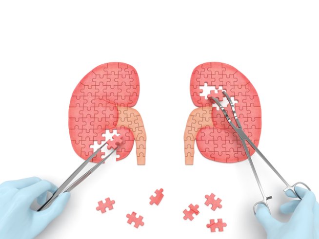 Снимка: istock