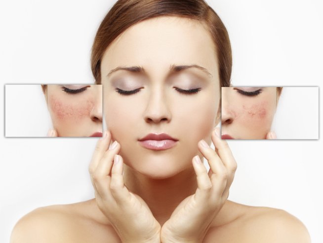 Снимка: Thinkstock