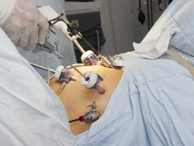 Снимка: Thinkstock