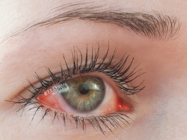 Снимка: istock