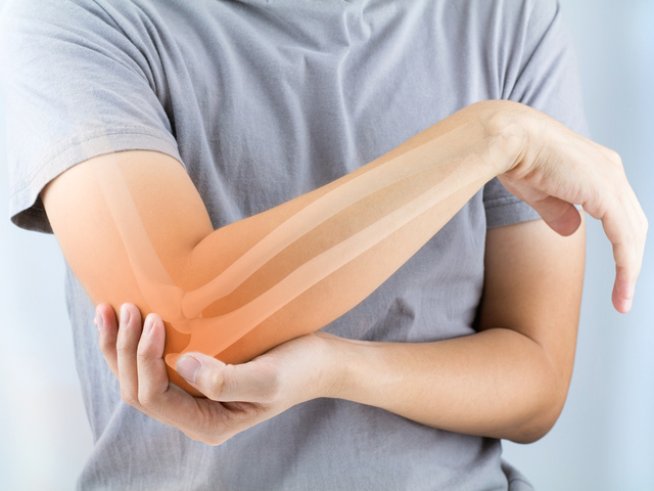 Снимка: istock