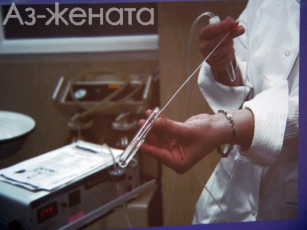 За пръв път яйцеклетка е замразена успешно в Канада през 2003
г. След двегодишни опити и само 4 години след канадските си колеги,българските специалисти също успяха да замразят и в последствие размразят и оплодят яйцеклетка.
