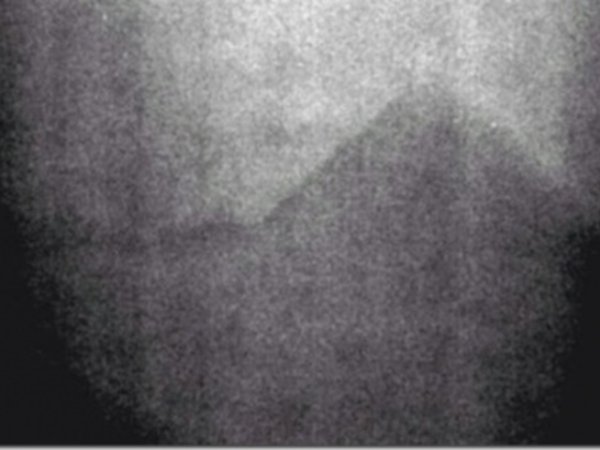 Пирамиди на Луната
Тази снимка е заснета по време на мисията на Аполо 17 и в архивите е считана като преекспонирана. Но много специалисти са работили над нея и контраста й, забелязвайки линия, която очертава нещо подобно на пирамида. Това дава основание на много хора по света да вярват, че на гърба на Луната има пирамиди.&nbsp;
Снимка: Nasa